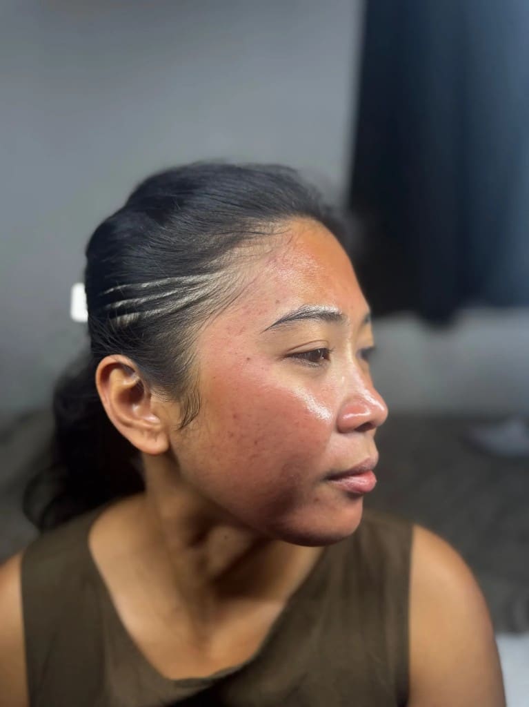 Skincare Consultations